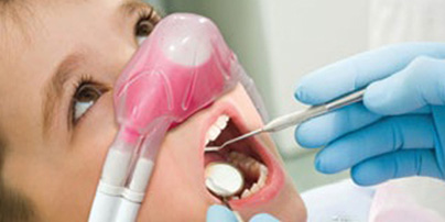 Why Laughing Gas Sedation is Safe. German Dentist Marbella, San Pedro
